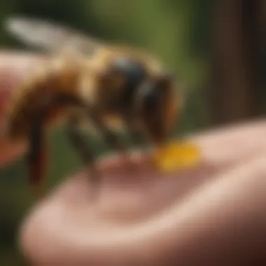 Proper Use of Bee Sting Treatment Tools Proper Use of Bee Sting Treatment Tools